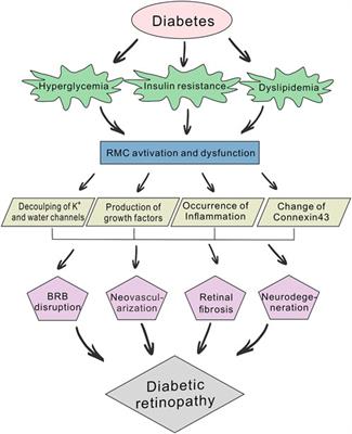 The role of retinal Müller cells in diabetic retinopathy and related therapeutic advances